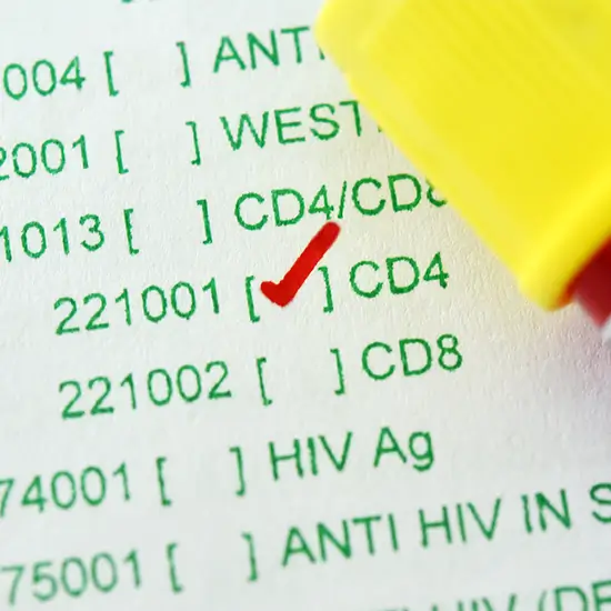 CD4 absolute count test